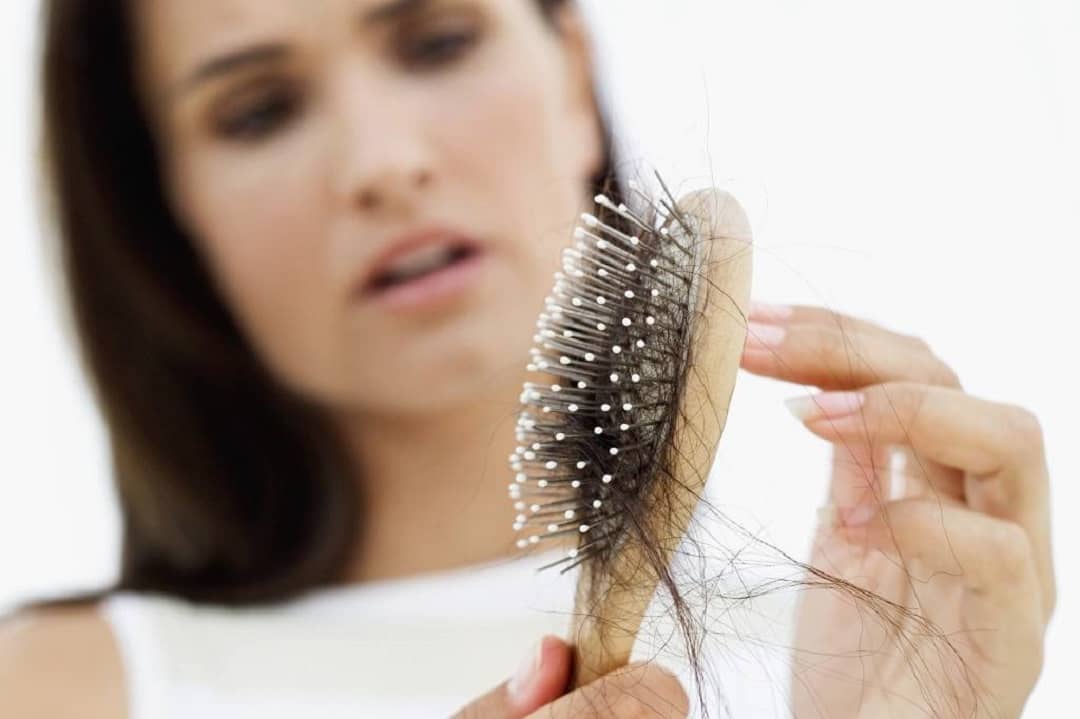 درمان سریع ریزش مو با طب سنتی