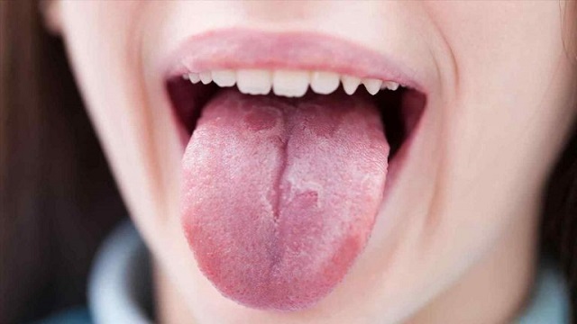 رنگ کبود روی زبان نشانه چیست؟