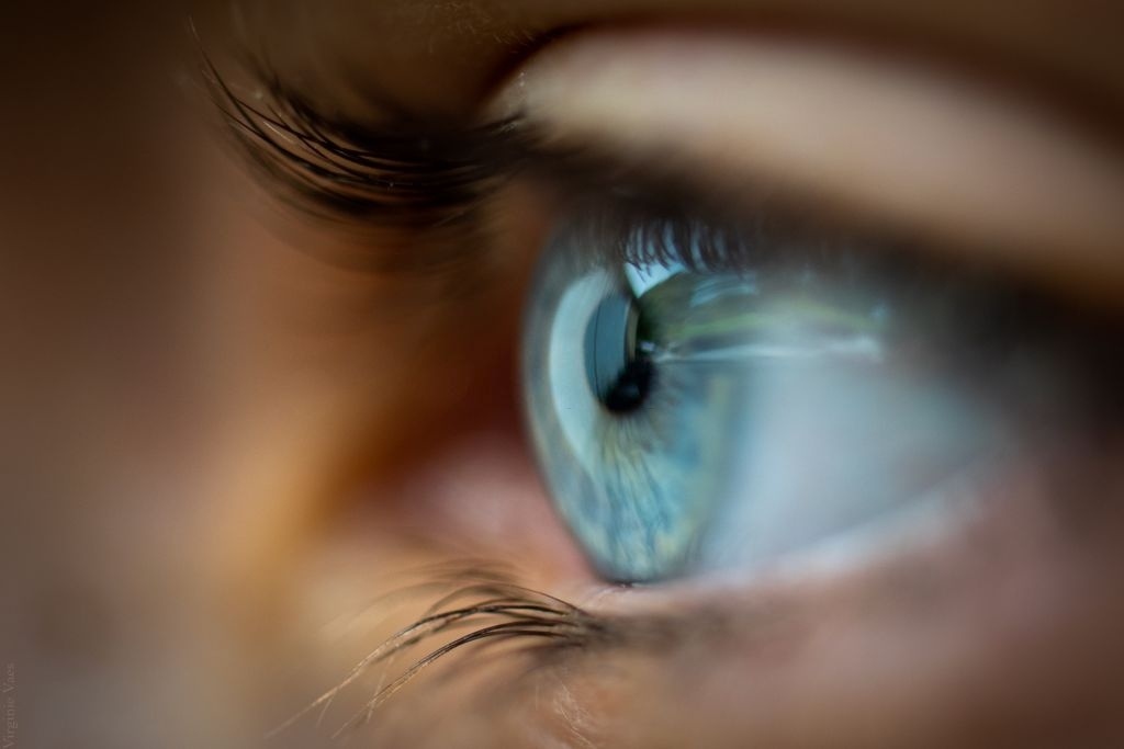 سندرم بینایی کامپیوتری یا CVS؛ علل، علائم و نشانه‌ها و روش درمان آن