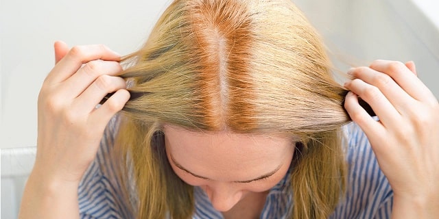 چرا موها بعد از دکلره نارنجی می شود؟