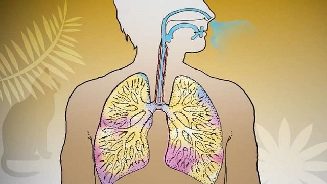 علل و عوامل تحریک کننده در ابتلا به بیماری آسم