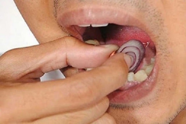 پیاز برای سلامت دهان و دندان