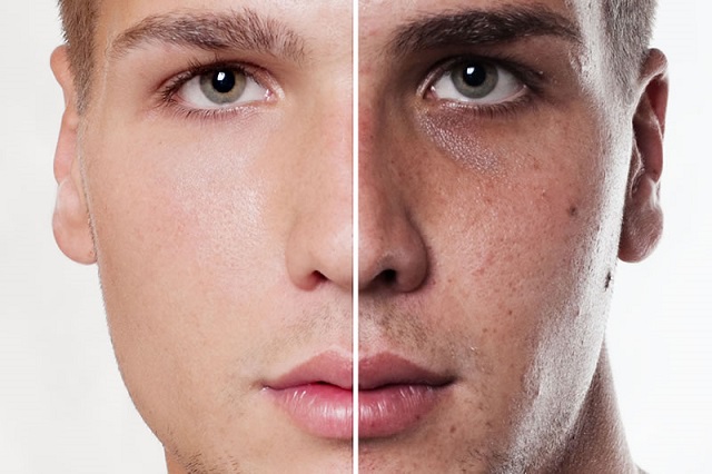 فوتوفیشال، روشی مؤثر برای جوانسازی پوست صورت آقایان