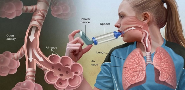 کاهش التهاب مهم ترین اثر ورزش بر آسم
