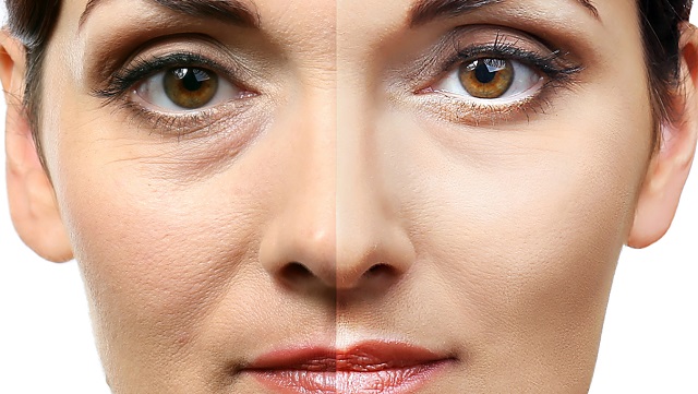 جوانسازی پوست با لیزر چیست