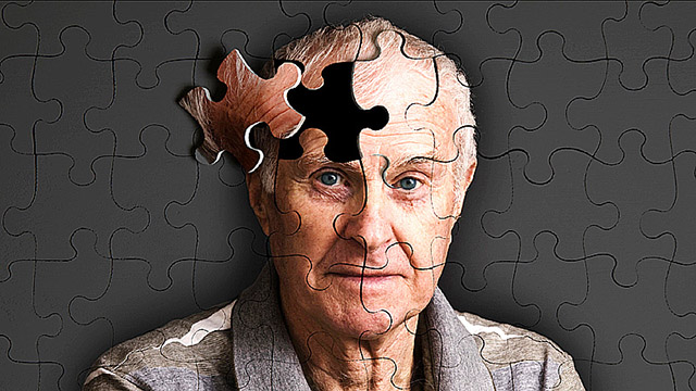 6 روش آسان اما موثر برای پیشگیری از آلزایمر زودرس در جوانی و سالمندی
