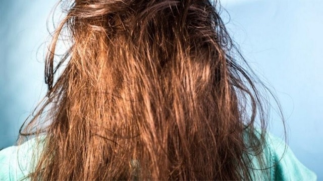 چربی مو از مضرات روغن زیتون برای موی سر است