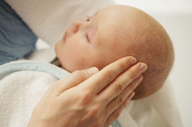 درمان عرق سوز شدن گردن نوزاد