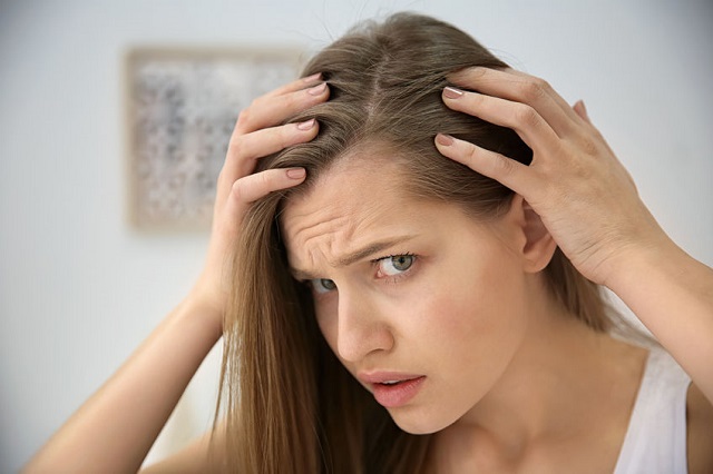 علل شایع ریزش مو در زنان چیست؟