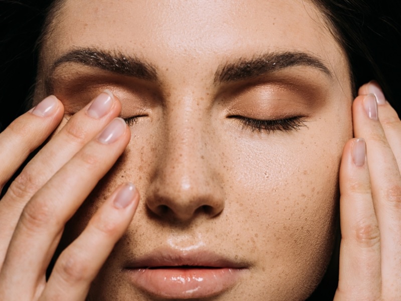 علت تیرگی پوست صورت و بدن + 32 روش موثر پیشگیری و درمان