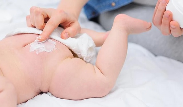 درمان سریع سوختگی پای نوزاد با پوشک