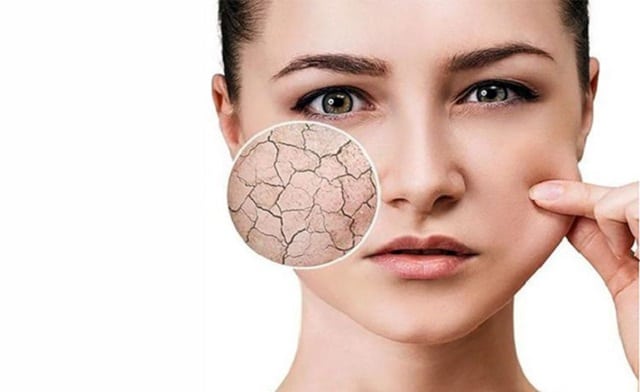 نشانه‌های پوست خشک؛ آیا پوست شما واقعاً خشک است؟