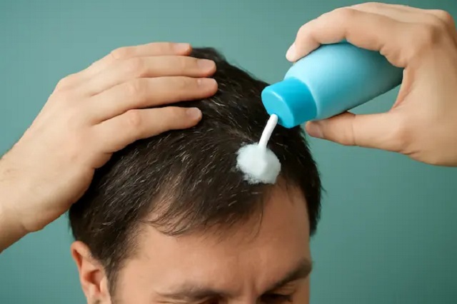ترکیبات فعال در شامپوی ضدشوره؛ پشت پرده این محصولات چیست؟ ترکیبات فعال در شامپوی ضدشوره؛ پشت پرده این محصولات چیست؟